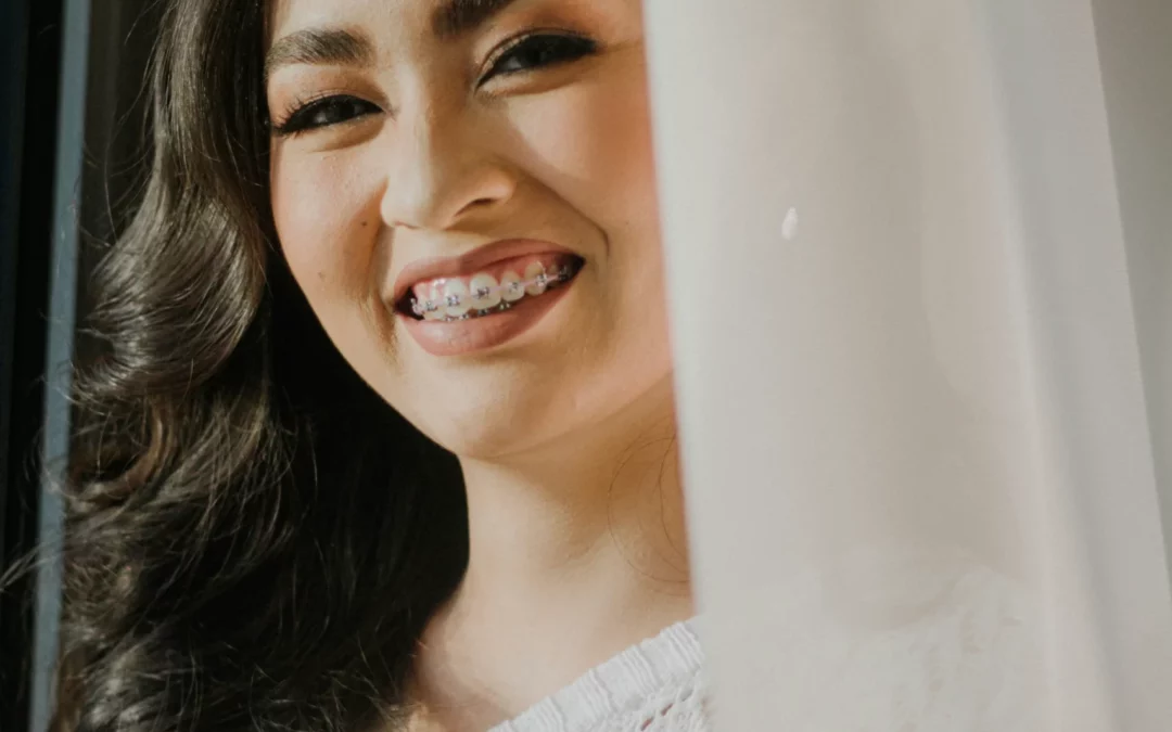 Dental Diastema: Causes and Treatments