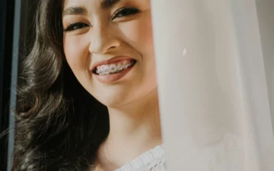 Dental Diastema: Causes and Treatments