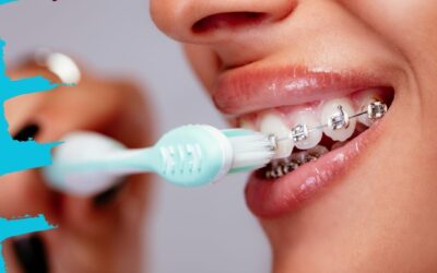 l’Hygiène Dentaire en Orthodontie (Le Guide Complet)