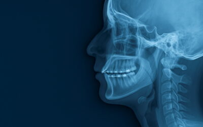 Et si votre mâchoire influençait votre posture, votre sommeil… et votre performance physique ?