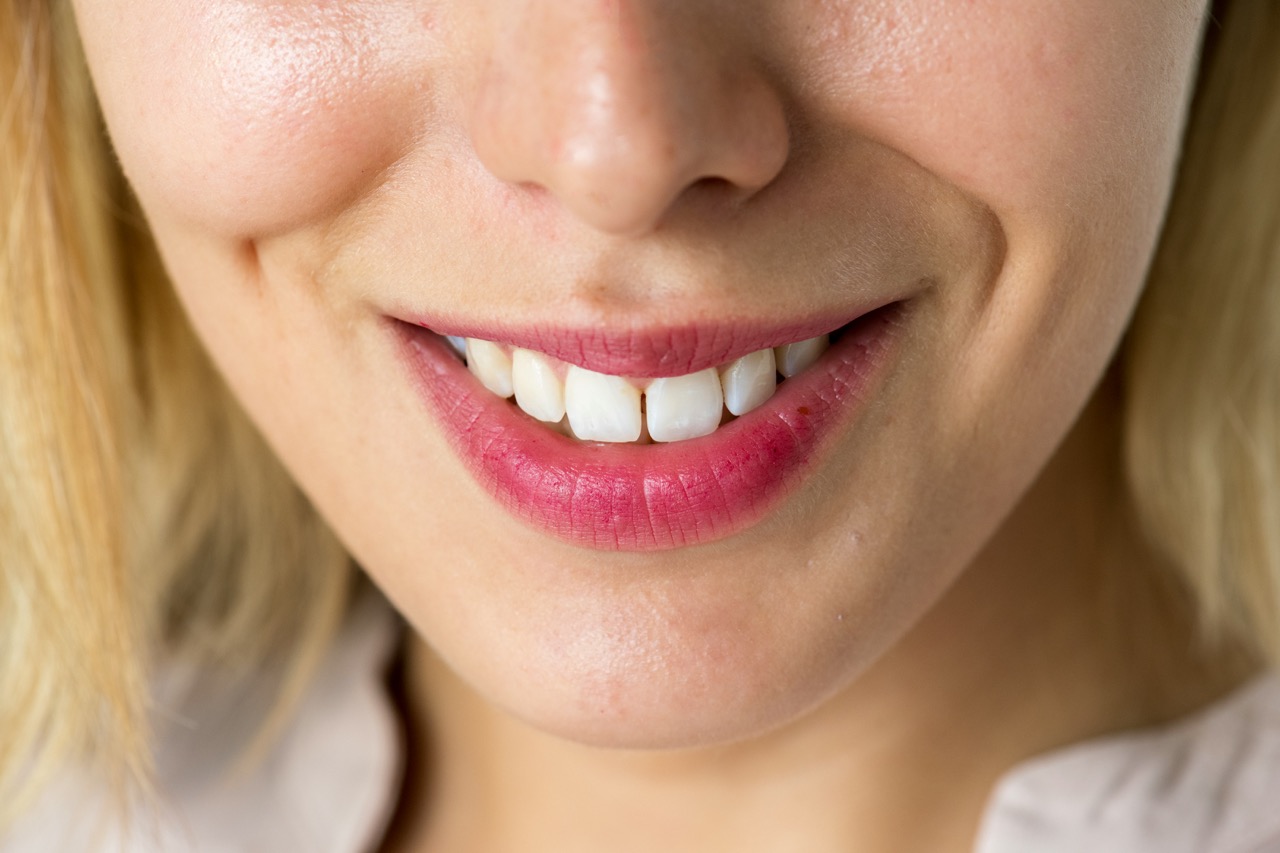 orthodontie adulte Archambault et Morton