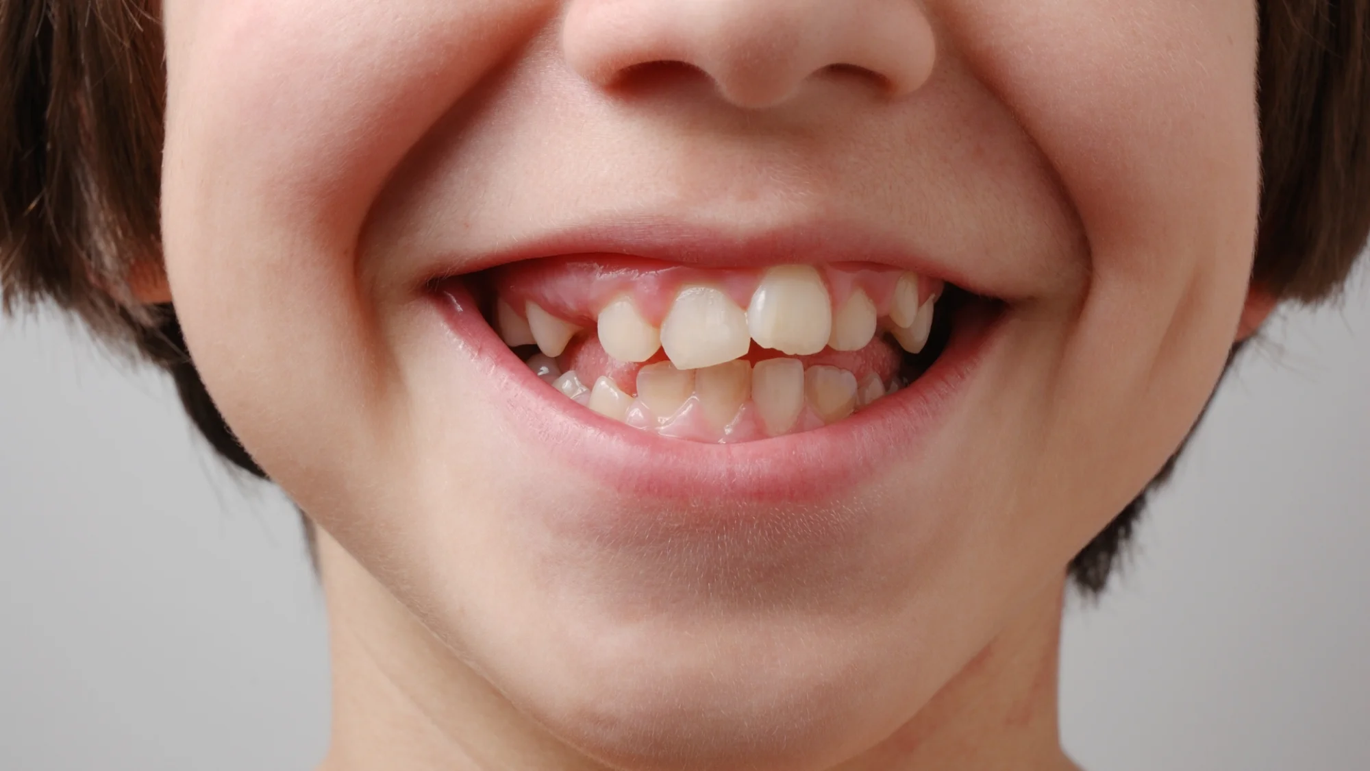 sourire avec confiance chez Archambault morton orthodontiste pour adulte