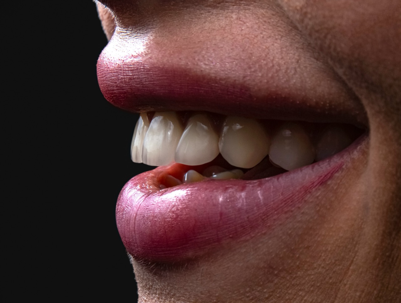 Il n'y a pas d'âge pour un beau sourire
